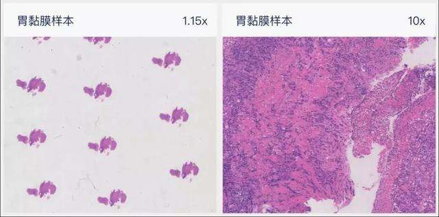 深耕“人工智能+医疗”产业，这几家园企走在了行业前列